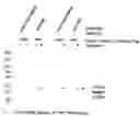 Fig. 01 - Processes for purification of recombinant proteins