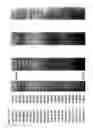Fig. 303 - ANGE gene in atopy