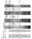 Fig. 304 - ANGE gene in atopy