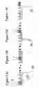 Fig. 14 - Method and device for chemical or biological analysis by a sensor with a monolithic chamber in the form of a multi-microtubular sheaf and a lateral integration measuring transducer