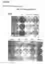 Fig. 04 - Culture medium composition, culture method, and myoblasts obtained, and their uses