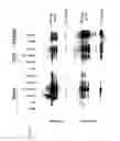 Fig. 06 - Retroviral vector