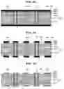 Fig. 11 - Method for manufacturing electronic component-embedded printed circuit board