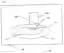 Fig. 01 - Method of forming a metal trace