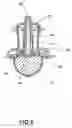 Fig. 06 - TOP ASSEMBLY