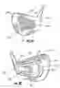 Fig. 04 - Golf club trainer