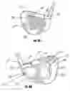 Fig. 07 - Golf club trainer