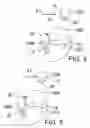 Fig. 04 - Sphere and needle alignment indicia for head of golf putter
