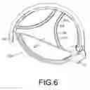 Fig. 07 - Model of a golf club head for molding