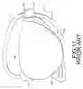 Fig. 12 - Model of a golf club head for molding