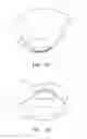 Fig. 16 - Golf Club Head