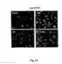 Fig. 27 - Methods and pharmaceutical compositions for healing wounds