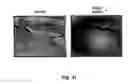 Fig. 34 - Methods and pharmaceutical compositions for healing wounds