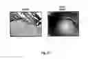 Fig. 35 - Methods and pharmaceutical compositions for healing wounds