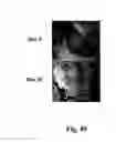 Fig. 52 - Methods and pharmaceutical compositions for healing wounds