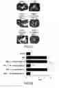 Fig. 05 - Compositions and methods for the treatment of inflammatory bowel disease utilizing NF-kappaB decoy polynucleotides