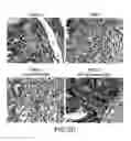Fig. 11 - Compositions and methods for the treatment of inflammatory bowel disease utilizing NF-kappaB decoy polynucleotides