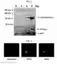 Fig. 02 - Method for inhibition of lipogenesis by regulating PRP19 expression