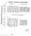 Fig. 03 - Method for improving respiratory function and inhibiting muscular degeneration