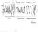 Fig. 05 - Method for improving respiratory function and inhibiting muscular degeneration