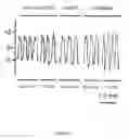 Fig. 06 - Method for improving respiratory function and inhibiting muscular degeneration
