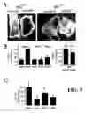 Fig. 12 - Method of treatment of myocardial infarction