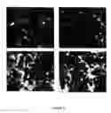 Fig. 07 - Use of opioid antagonists to attenuate endothelial cell proliferation and migration