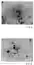 Fig. 04 - Anti-tumor substances