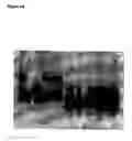 Fig. 06 - High resolution analysis of genetic variation within cryptosporidium parvum