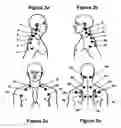 Fig. 08 - Therapeutic methods using electromagnetic radiation