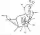 Fig. 01 - Anterior segment ventricular restoration apparatus and method