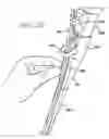 Fig. 04 - Apparatus useful for positioning a device on an endoscope