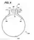 Fig. 09 - Apparatus useful for positioning a device on an endoscope