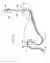 Fig. 17 - Apparatus useful for positioning a device on an endoscope