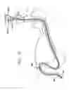 Fig. 18 - Apparatus useful for positioning a device on an endoscope
