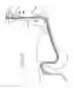Fig. 19 - Apparatus useful for positioning a device on an endoscope
