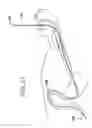 Fig. 20 - Apparatus useful for positioning a device on an endoscope