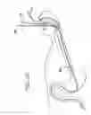 Fig. 21 - Apparatus useful for positioning a device on an endoscope