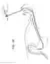 Fig. 23 - Apparatus useful for positioning a device on an endoscope