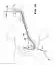 Fig. 25 - Apparatus useful for positioning a device on an endoscope