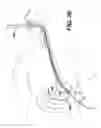 Fig. 27 - Apparatus useful for positioning a device on an endoscope