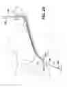 Fig. 28 - Apparatus useful for positioning a device on an endoscope