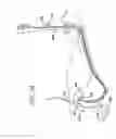 Fig. 33 - Apparatus useful for positioning a device on an endoscope