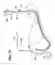 Fig. 34 - Apparatus useful for positioning a device on an endoscope