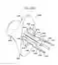 Fig. 40 - Apparatus useful for positioning a device on an endoscope