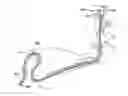 Fig. 01 - Method of inserting a feeding tube