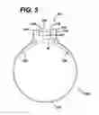 Fig. 09 - Method of inserting a feeding tube
