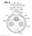 Fig. 12 - Method of inserting a feeding tube