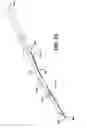 Fig. 14 - Method of inserting a feeding tube