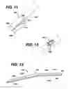 Fig. 15 - Method of inserting a feeding tube